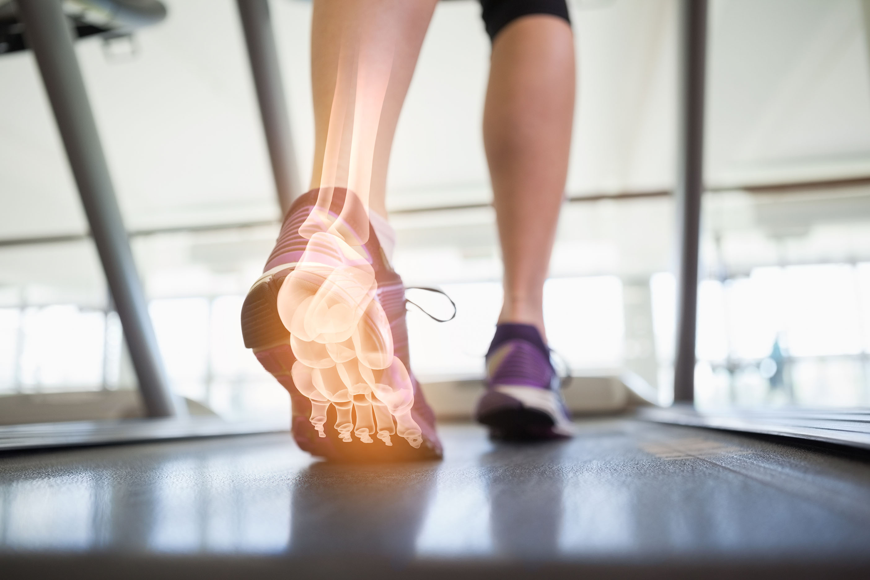Diabetes and Feet – Overview