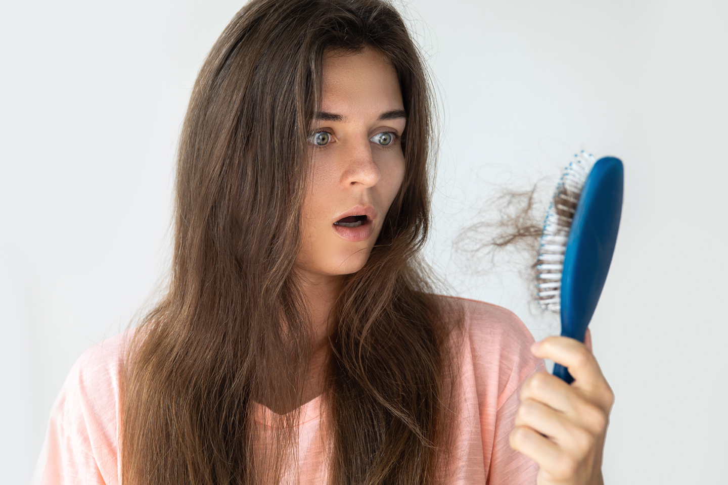 FAQs about PCOS & Hair Loss