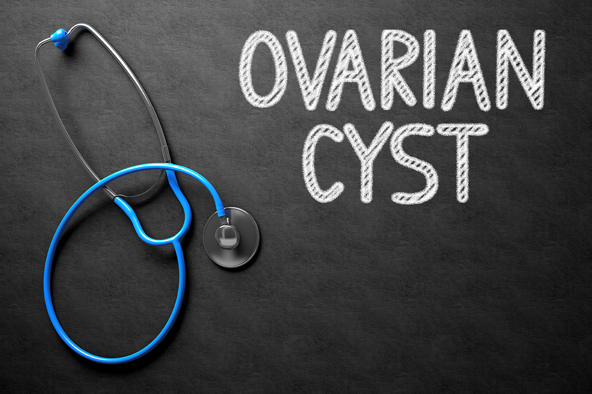 PCOS Diagnosis